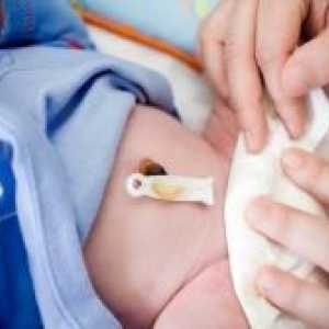 Cum se vindeca buricul unui nou-născut?