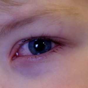Copilul are ochii roșii, de ce și ce să fac?