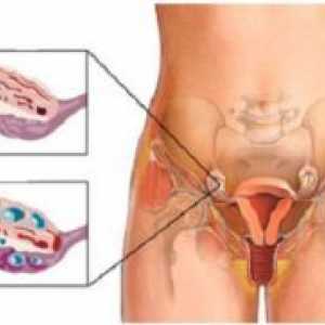 Creșterea ovar la femei - cauze