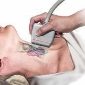 Nodulii asupra glandei tiroide - cauze, simptome, tratament