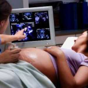 Uzi la 33 de săptămâni de sarcină - regulile