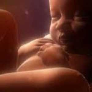 Infecție intrauterină la nou-nascuti