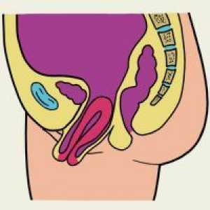 Prolaps uterin - ce să fac?