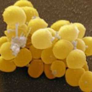 Staphylococcus aureus - Simptome