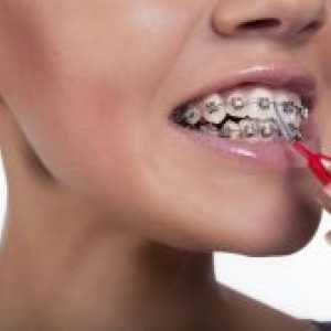 Periuța de dinți pentru bretele